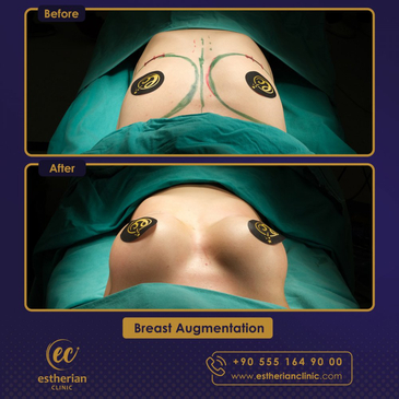 Slider image (9) Estherian Clinic